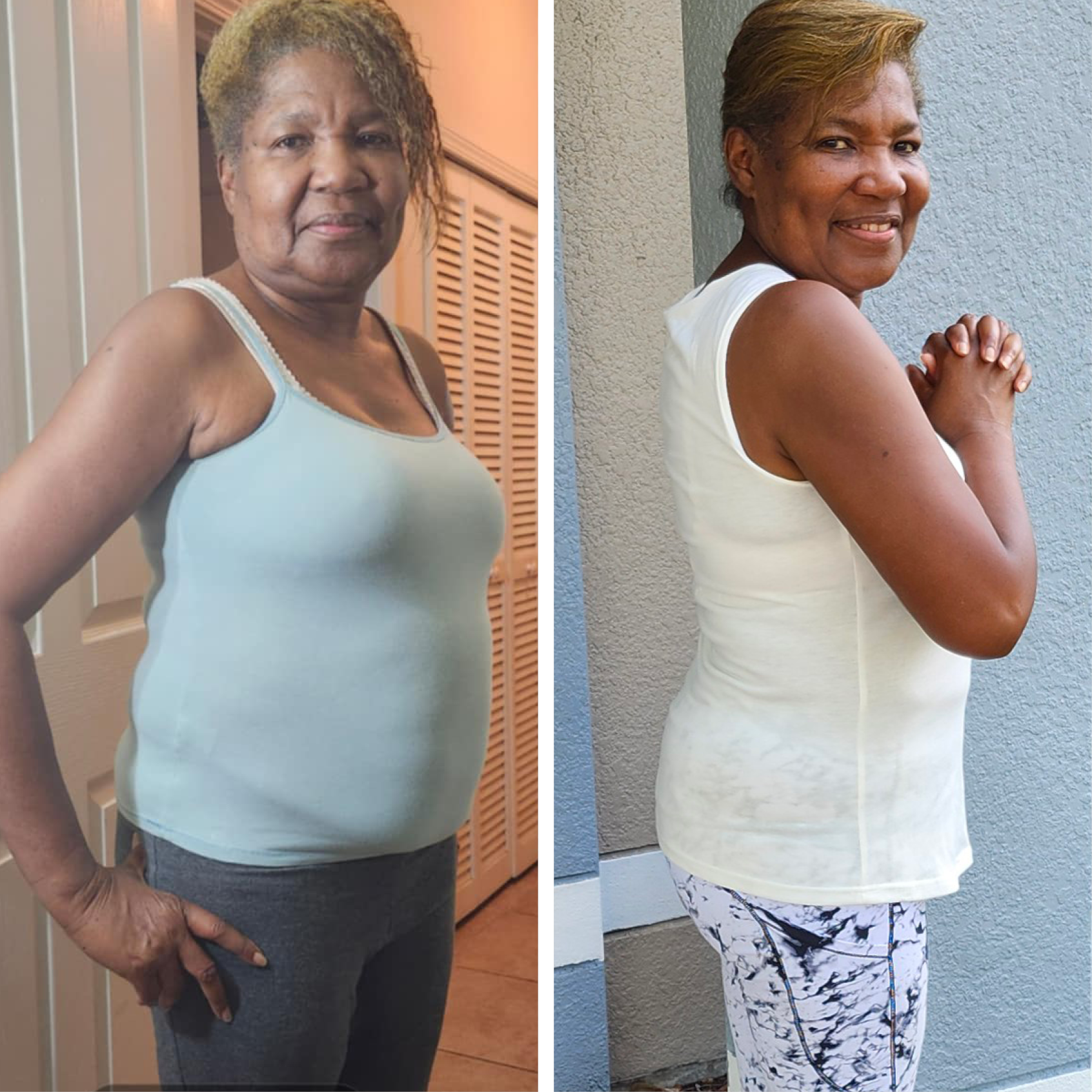 Toni B. before and after — lost 22 lbs in 60 days with Trimsulin